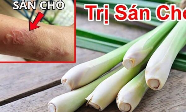 Cách Trị Bệnh Sán Chó Tại Nhà: Hướng Dẫn An Toàn và Khoa Học